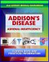 21st Century Addison's Disease Sourcebook: Clinical Data for Patients, Families, and Physicians, including Adrenal Insufficiency, Adrenocortical Hypofunction, Hypocortisolism, and Related Conditions by Progressive Management
