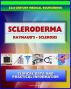 21st Century Scleroderma Sourcebook: Clinical Data for Patients, Families, and Physicians, including Morphea and Linear, Systemic Sclerosis, Raynaud's Phenomenon, Sclerodactyly, Related Conditions by Progressive Management