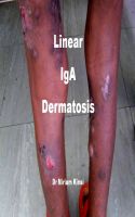 Cover for 'Linear IgA Dermatosis'