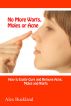 No More Warts, Moles or Acne by Alex Buckland