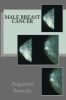 Cover for 'Male Breast Cancer'