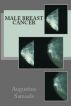 Male Breast Cancer by Augustine Samuels