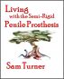 Living with the Semi-Rigid Penile Prosthesis by Sam Turner