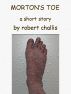 Morton's toe by Robert Challis