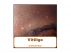 Vitiligo by Miriam Kinai