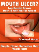 Cover for 'Mouth Ulcers? Top Dentist Shows How to Get Rid for Good! Simple Home Remedies that Work Fast!'