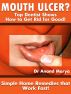 Mouth Ulcers? Top Dentist Shows How to Get Rid for Good! Simple Home Remedies that Work Fast! by Greatest Books