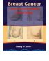 Breast Cancer - Step to curb female silent killer by Henry Emili