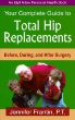 Your Complete Guide to Total Hip Replacements: Before, During, and After Surgery by Jennifer Frantin