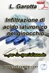 Infiltrazione di acido ialuronico nel ginocchio... per lo specializzando by Lorenzo Garotta